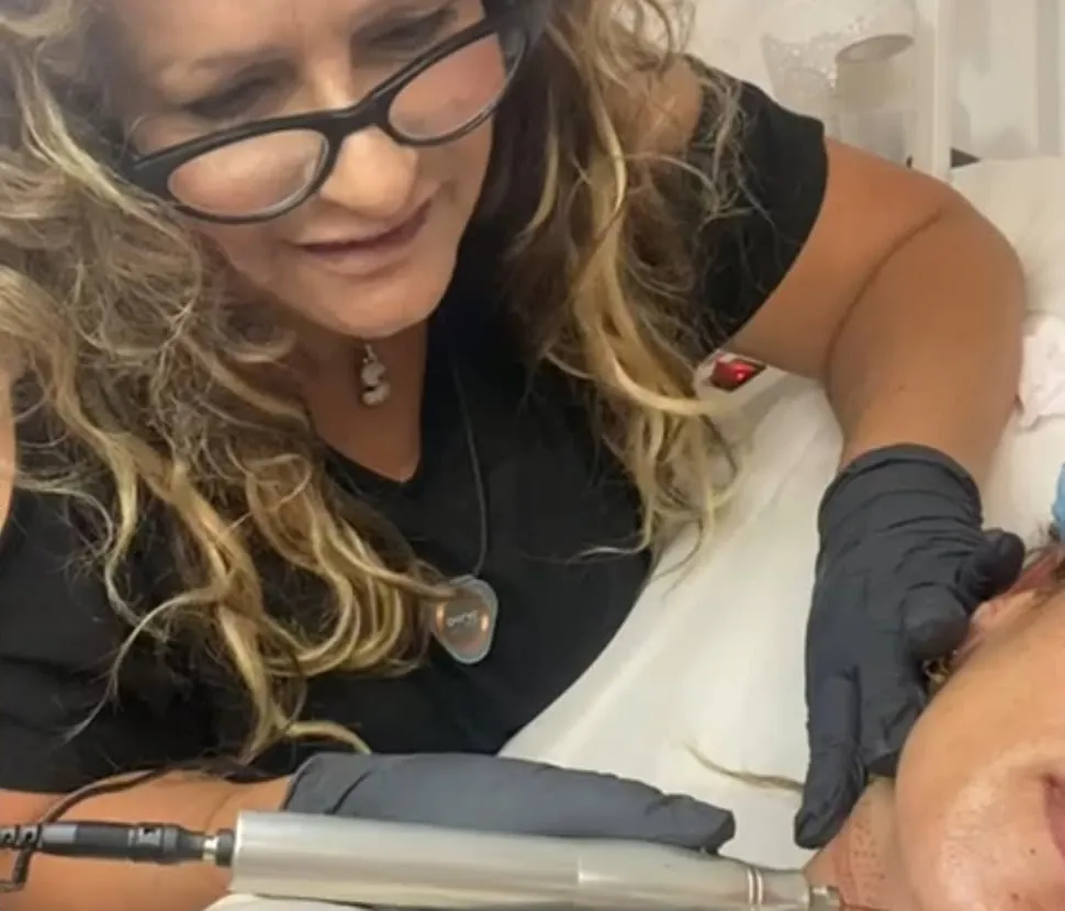 שלומית רייך מטפלת במכשיר מיקרו־מחטים בקליניקה